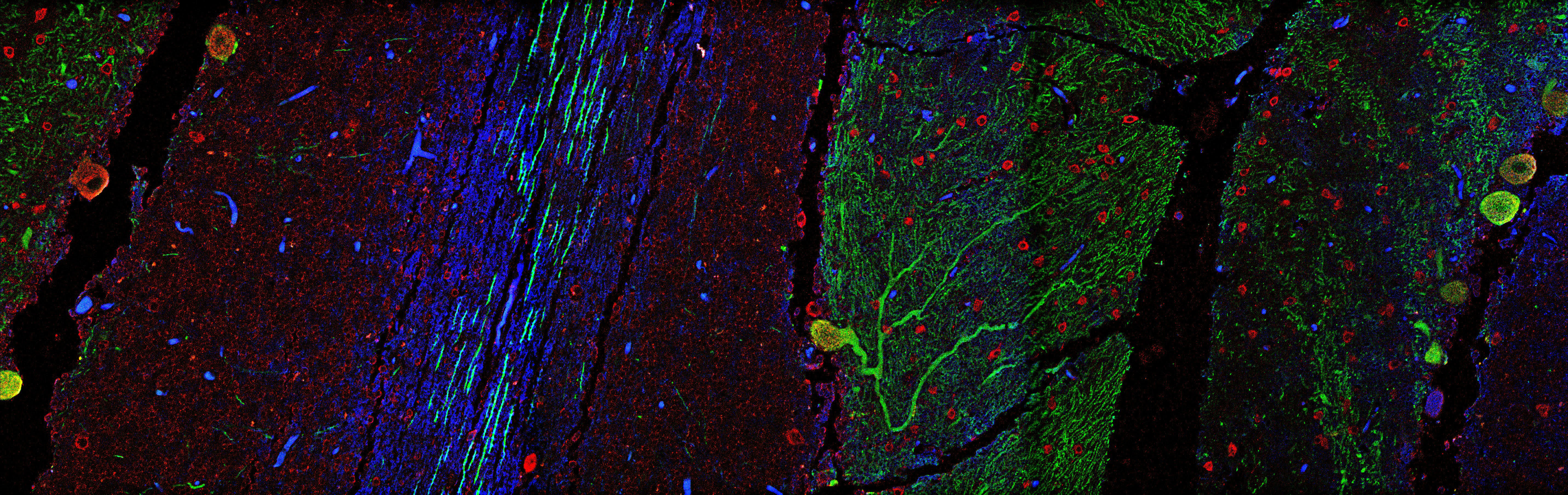 Immunohistochemistry imaging of a human cerebellum, with antibodies specific for Calbindin (green) and poly-ADP-ribosylation (PAR, red), as well as DNA (blue, stained with DAPI)